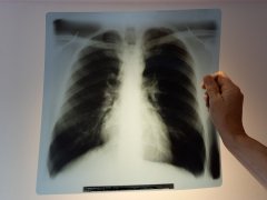 Alte Röntgenbilder – zu schade für die Mülltonne